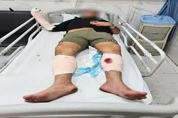 شرور سابقه‌دار عامل ضرب‌وشتم بانوان با شلیک پلیس تهران زمین‌گیر شد