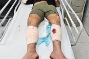 شرور سابقه‌دار عامل ضرب‌وشتم بانوان با شلیک پلیس تهران زمین‌گیر شد