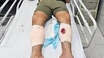 شرور سابقه‌دار عامل ضرب‌وشتم بانوان با شلیک پلیس تهران زمین‌گیر شد