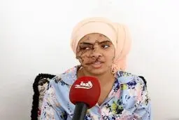 فیلم ۱۳۰ بخیه بر صورت و دستان زن جوان؛ شوهر سابقش او را با چاقو زخمی کرد+ ویدیو