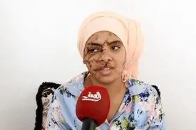 فیلم ۱۳۰ بخیه بر صورت و دستان زن جوان؛ شوهر سابقش او را با چاقو زخمی کرد+ ویدیو