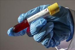 شناسایی موارد ابتلا به کرونا در بحرین و کویت