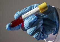 شناسایی موارد ابتلا به کرونا در بحرین و کویت