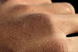 راههای مقابله با خشکی پوست دست در روزهای کرونایی