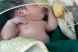 رئیس دانشگاه علوم پزشکی بابل خبر داد زایمان مادر باردار مشکوک به کرونا در بابل