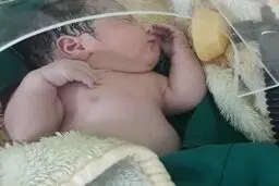 رئیس دانشگاه علوم پزشکی بابل خبر داد زایمان مادر باردار مشکوک به کرونا در بابل
