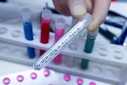 اگر این ۳ علامت را همزمان داشتید کرونا مثبت هستید!/ چرا خطر کرونا از آنفلوآنزا کمتر است؟!