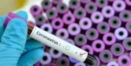 ایتالیا در مرگ و میر بر اثر ابتلا به «کرونا» رکورد جدید زد