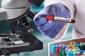راه‌اندازی آزمایشگاه تشخیص کرونا در پژوهشگاه رویان