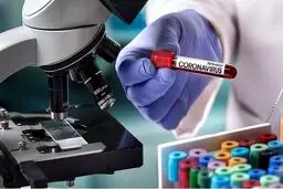 راه‌اندازی آزمایشگاه تشخیص کرونا در پژوهشگاه رویان