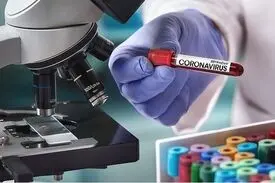 راه‌اندازی آزمایشگاه تشخیص کرونا در پژوهشگاه رویان