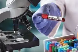 راه‌اندازی آزمایشگاه تشخیص کرونا در پژوهشگاه رویان