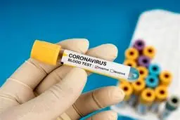 چه کسانی در بی توجهی مردم به بیماری کرونا مقصرند؟