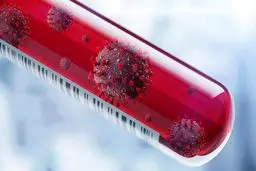 آخرین آمارها و اطلاعات درباره شیوع جهانی کرونا