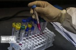 ۶۶ درصد جمعیت هدف در استان مرکزی درخصوص کرونا غربالگری شده اند