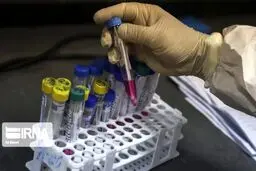 ۶۶ درصد جمعیت هدف در استان مرکزی درخصوص کرونا غربالگری شده اند