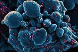 بالا بودن آسیب پذیری مردان نسبت به کرونا/ از شایعه تا واقعیت