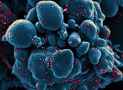 بالا بودن آسیب پذیری مردان نسبت به کرونا/ از شایعه تا واقعیت