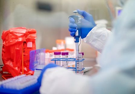 تایید نهایی کیت‌های تشخیص کرونا ۳ شرکت از سوی ۲ نهاد/تولید انبوه به شرط تایید هیات امنا ارزی