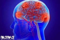 اختلالات مغزی، علامت دیگر کرونا