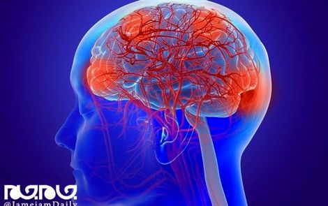 اختلالات مغزی، علامت دیگر کرونا