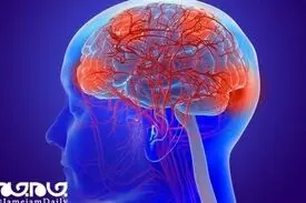 اختلالات مغزی، علامت دیگر کرونا