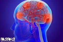اختلالات مغزی، علامت دیگر کرونا