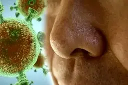 علامتی که می‌تواند نشانه ابتلا به ویروس کرونا باشد