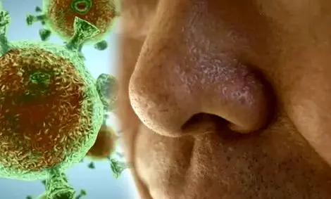 علامتی که می‌تواند نشانه ابتلا به ویروس کرونا باشد