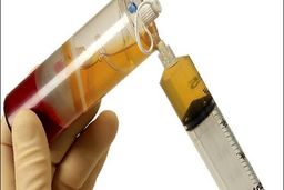 جزییات اهدای پلاسمای خون توسط «بهبود یافتگان» کرونا