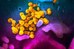 بیش از ۳۰ درصد بیماران مبتلا به کرونا علائم عصبی دارند