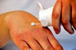 ویروس کرونا؛ چگونه پوست دست را از خشک شدن نجات دهیم؟