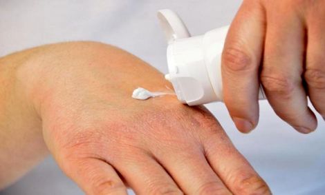 ویروس کرونا؛ چگونه پوست دست را از خشک شدن نجات دهیم؟