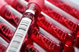 نذر اهدای خون را به شب‌های قدر موکول نکنید