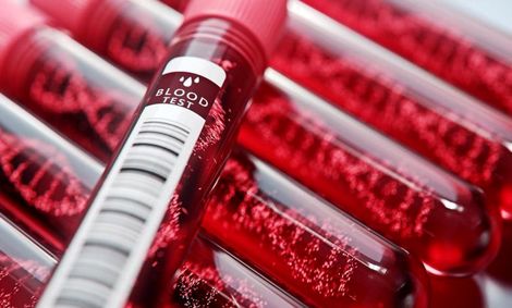 نذر اهدای خون را به شب‌های قدر موکول نکنید