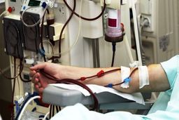 افزایش آمار مرگ و میر ناشی از بیماری مزمن کلیه در جهان