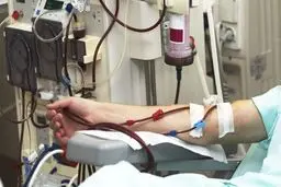 افزایش آمار مرگ و میر ناشی از بیماری مزمن کلیه در جهان