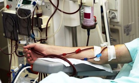 افزایش آمار مرگ و میر ناشی از بیماری مزمن کلیه در جهان