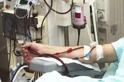 افزایش آمار مرگ و میر ناشی از بیماری مزمن کلیه در جهان