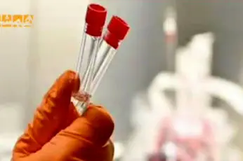 چه کسانی بیشتر در معرض خطر COVID-۱۹ است؟