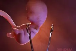 محرز: ویروس کرونا باعث سقط جنین نمی‌شود