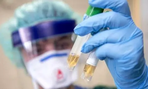 شناسایی روش جدیدی برای کاهش شدت علائم کووید-۱۹