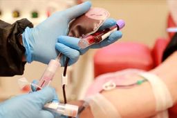 بهبودیافتگان کرونا پلاسمای خون خود را اهدا کنند