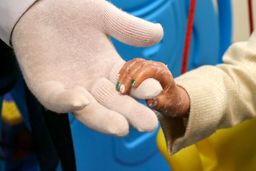 یونیسف پانسمان‌های مخصوص کودکان مبتلا به بیماری پوستی پروانه‌ای را به ایران ارسال کرد