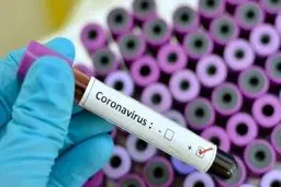 کیت های ایرانی تشخیص کرونا به آلمان رسید