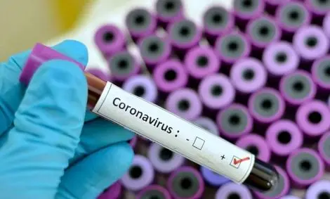 کیت های ایرانی تشخیص کرونا به آلمان رسید