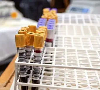 کدام گروه‌های خونی بیشتر به کرونا مبتلا می‌شوند؟