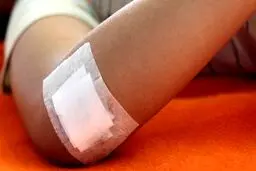 کرونا از راه زخم هم منتقل می‌شود؟