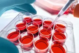 احتمال درمان کرونا ویروس از طریق سلول‌های بنیادی