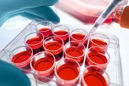 احتمال درمان کرونا ویروس از طریق سلول‌های بنیادی